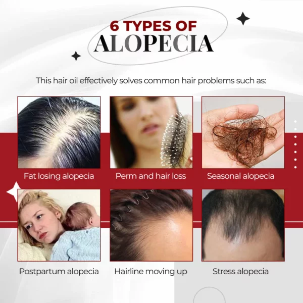 Mujeres 100% Vegan Cafeína Anti Alopecia Aceite Capilar Crecimiento Rápido