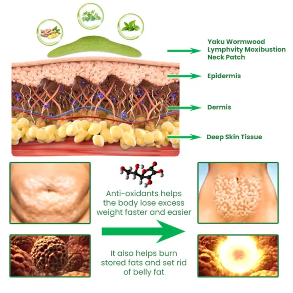 Yaku Wormwood Lymphvity Moxibustion kakla plāksteris