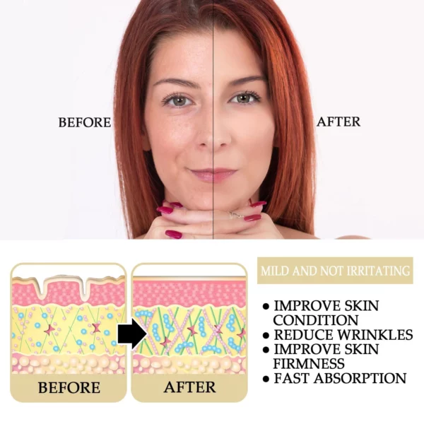 Suero reparador y renovador de la piel para la reducción rápida de arrugas faciales Youthful™