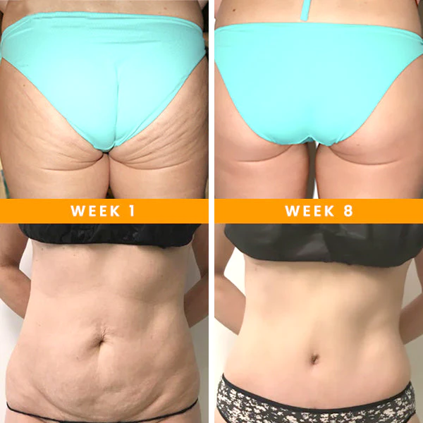 powerganic+ SkinRescue Vitamin C Seife