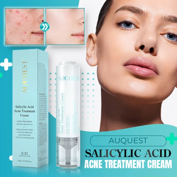 AUQUEST Salicylic Acid Acne Treatment Cream Wowelo Your Smart