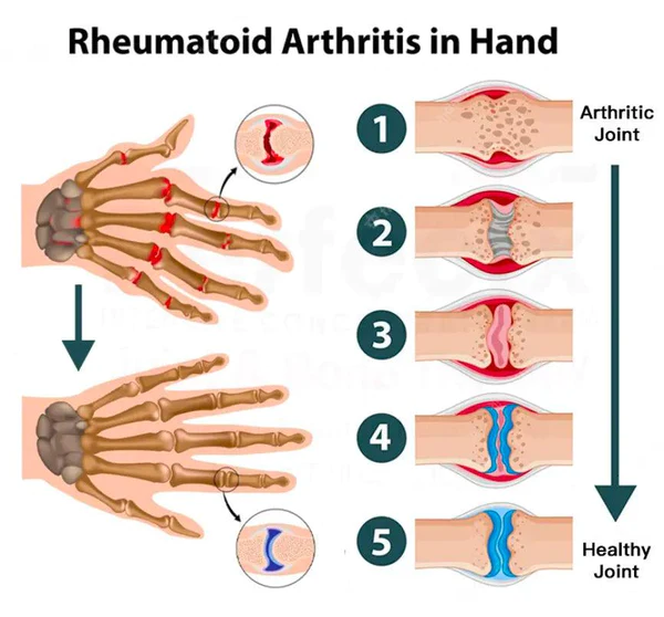 Advanced™ Joint & Bone Therapy Gel