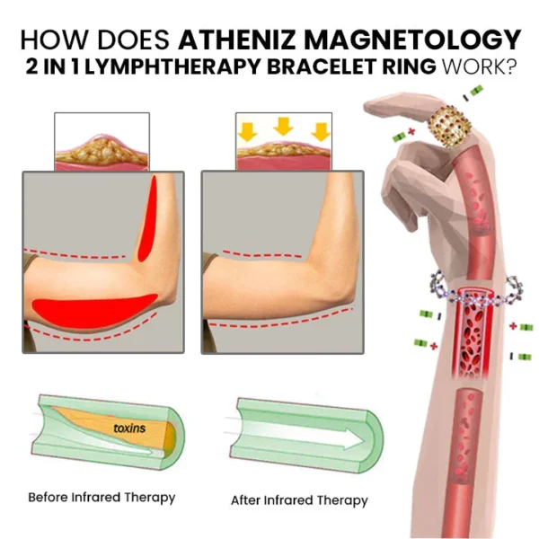 Atheniz Magnetology 2 IN 1 LymphTherapy Bracelet Ring