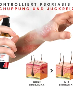 BIORAMAX PsoriaRescue Behandlung Spray