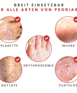 BIORAMAX PsoriaRescue Behandlung Spray