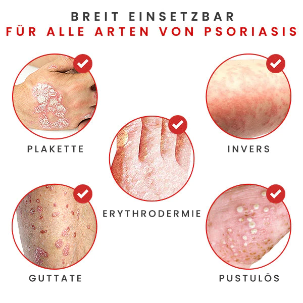 BIORAMAX PsoriaRescue Behandlung Sprey