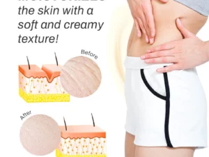 BURNUP AntiCellulite Body Wand