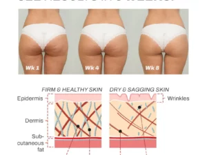 BURNUP AntiCellulite Body Wand