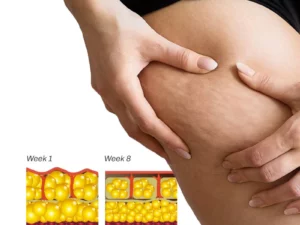 BURNUP AntiCellulite Body Wand