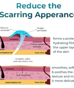 Bioskin™ Advanced Scar Removal Gel