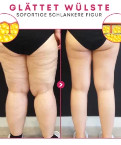 BodiFix Wiederherstellen & Straffen Oberschenkelwickel