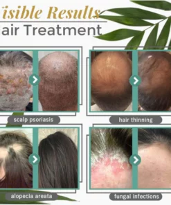 CPO™ Hair Grᴏwth and Nᴏurishing Serum