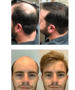 Caffeine Hair Revival & Darkening Serum