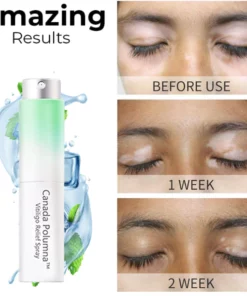Canada Polumna™ Vitiligo Relief Spray