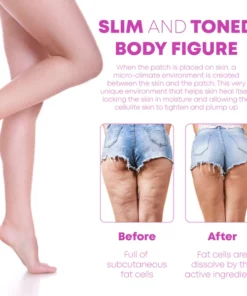 CelluFirm BodyTightening ThighWrap