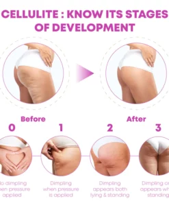 CelluFirm BodyTightening ThighWrap