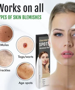 ClearSkin™ Spots Removal Pen
