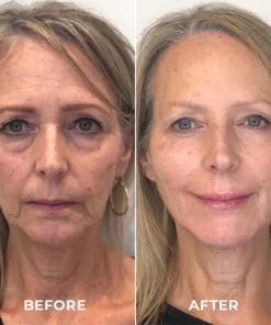 Clinical™ Golden Collagen Lace Silk Mask