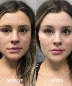 Clinical™ Retinol VC Wrinkle Serum