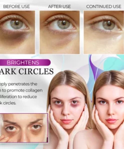 DEleven Pro-Xylane Active Eye Cream