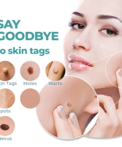 DR. Reilly™ Skin Tag Remover