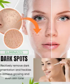 SPECIFICATIONS Ingredients: Collagen Net Weight: 30ml Shelf Life: 3 Years Target Age: Teens, Adults Target Audience: Men, Women, General, Unisex Applicable Body Parts: Face, Cheeks, neck, clavicle, T-Zone face Applicable Skin Types: All Skin types, most beneficial for dry, itchy, flaking, and aging skin Cosmetic Effects: Anti-Aging, Moisturizing, Scar treatment, Skin Brightening, Skin lightening, Anti-Wrinkle, Anti-eyebags PACKAGE INCLUDES X1 Dark Spot Corrector & Anti-Aging Collagen Serum