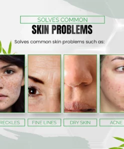 SPECIFICATIONS Ingredients: Collagen Net Weight: 30ml Shelf Life: 3 Years Target Age: Teens, Adults Target Audience: Men, Women, General, Unisex Applicable Body Parts: Face, Cheeks, neck, clavicle, T-Zone face Applicable Skin Types: All Skin types, most beneficial for dry, itchy, flaking, and aging skin Cosmetic Effects: Anti-Aging, Moisturizing, Scar treatment, Skin Brightening, Skin lightening, Anti-Wrinkle, Anti-eyebags PACKAGE INCLUDES X1 Dark Spot Corrector & Anti-Aging Collagen Serum