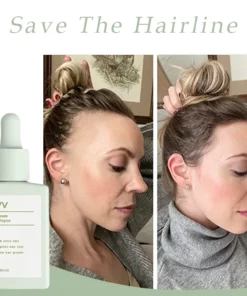 Divv™ Scalp Serum - Repair + Regrow Hair And Scalp