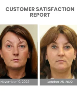 EMbelle Japan Ultimate 4D Airbag Vibration Eye Massager