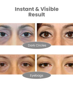 EMbelle Japan Ultimate 4D Airbag Vibration Eye Massager