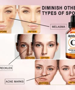 Exfolieskin™ Dark Spot Corrector & Anti-Aging Collagen Serum