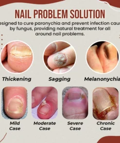 FeetFree™ Nail Anti-Fungus Socks