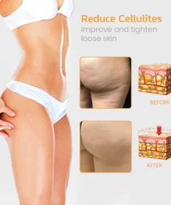 FitBod™ Anti-Cellulite Slimming Spray