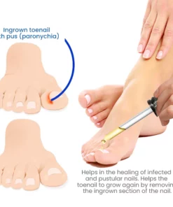 GERMAN Harivian® Anti Paronychia Relief Oil