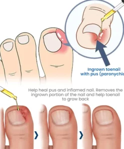 GERMAN Harivian® Anti Paronychia Relief Oil