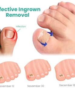 GERMAN HealExpert Paronychia Relief Patch