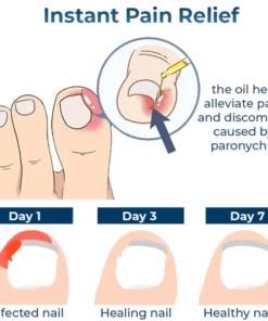 GFOUK™ German Anti Paronychia Relief Oil