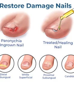 GFOUK™ German Anti Paronychia Relief Oil