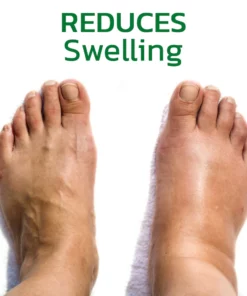 GFOUK™ GingerLegs Anti Swelling Detoxing Ointment