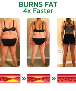 GFOUK™ GingerLegs Anti Swelling Detoxing Ointment