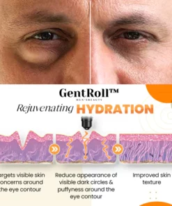 GentRoll™ Hyaluronic Acid Eyes Roller
