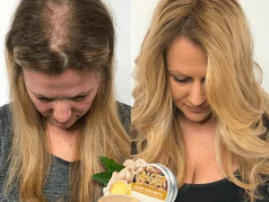 GingerPro Hair Regrowth Shampoo Bar