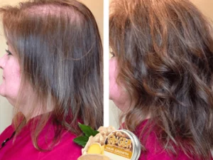 GingerPro Hair Regrowth Shampoo Bar