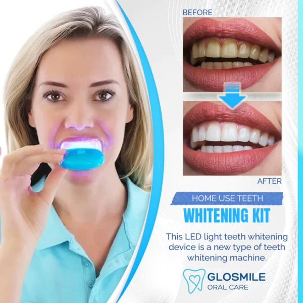 Комплект за избелване на зъби GloSmile за домашна употреба с LED светлина