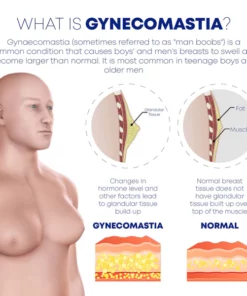 GynoBurn MenChest Sculpting Spray