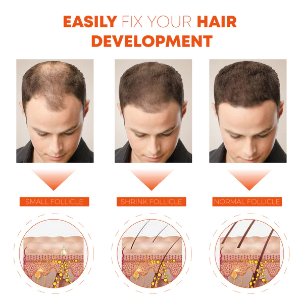 Hairfinity Minoxi RollOn GrowthTreatment