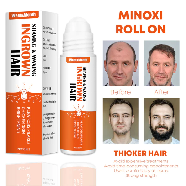 Hairfinity Minoxi RollOn GrowthTreatment