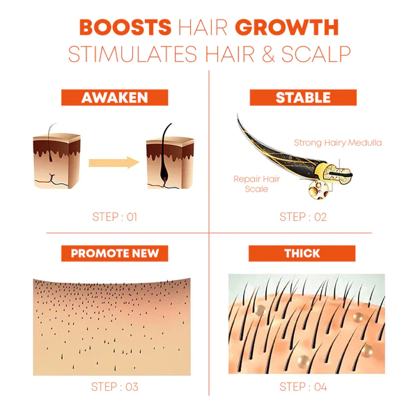 Hairfinity Minoxi RollOn GrowthTreatment