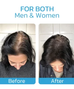 Hairmuch Hair Regrowth Ampoule Serum