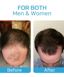 Hairmuch Hair Regrowth Ampoule Serum